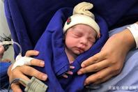 世界首例32岁不孕妇女接受死者子宫移植 成功诞下健康女婴