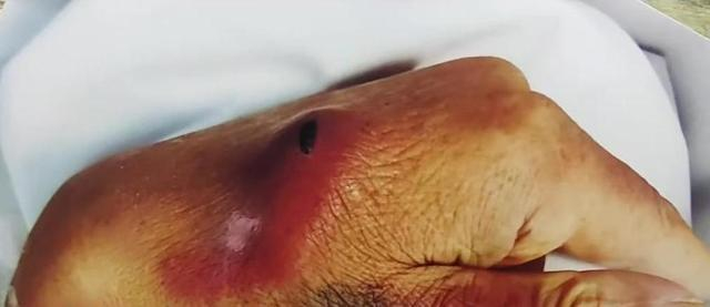 老人不“听话”就用剪刀扎?黑龙江一托老所因“虐老事件”被停业