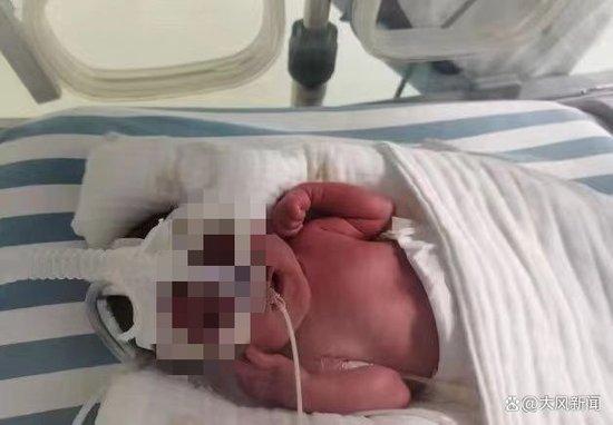 二胎在家早产带脐带送医，办出生证时被要求做亲子鉴定，医院：孩子院外已出母体