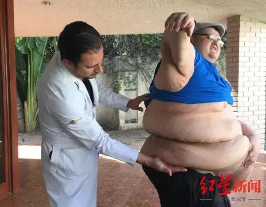 曾被认定“世界上最胖的人”病逝，终年41岁，一度重达近600公斤 多年无法站立行走，医生只能使用工业磅秤在卡车内为其称重