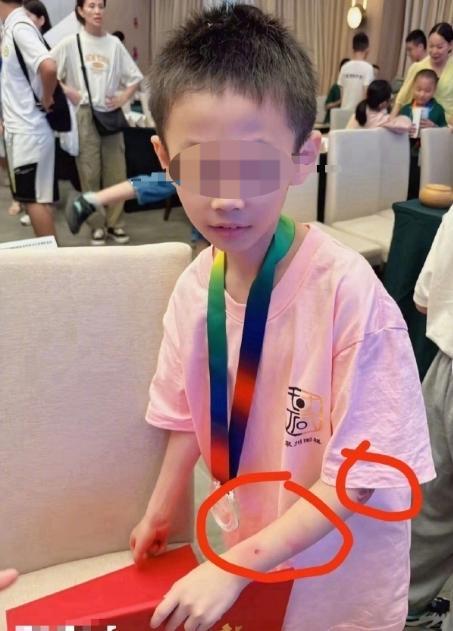 “我从来没有打伤过他”，9岁围棋少年坠亡，父亲回应家暴质疑