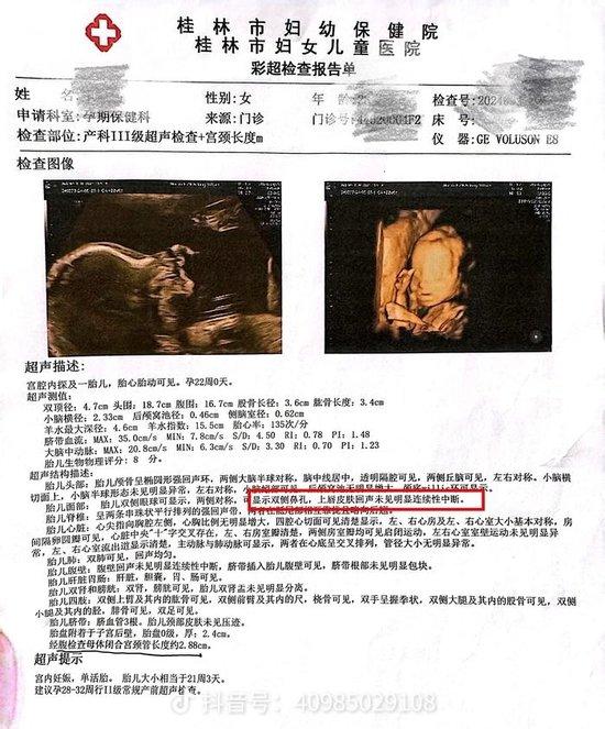 广西桂林女子质疑医院彩超漏诊遭卫生健康委工作人员呵斥,最新进展:漏诊问题仍在处理