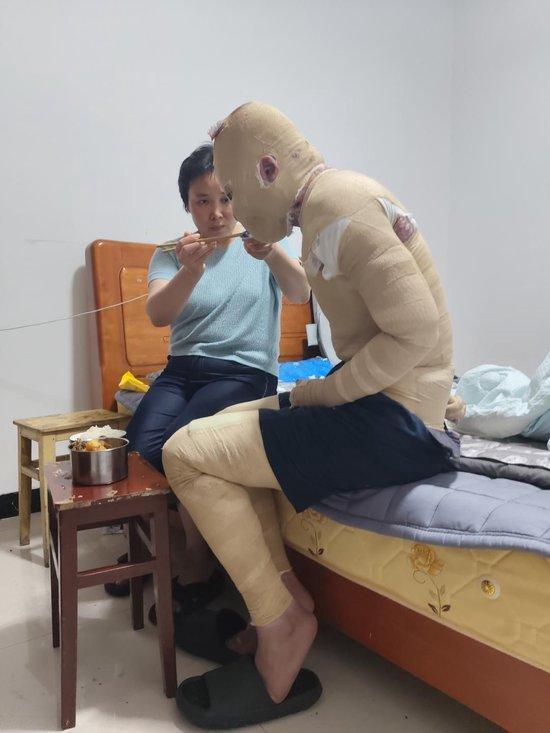 因室友电瓶燃爆烧伤案民事诉讼今日开庭 当事人:曾反复要求别带上楼,回来太晚没发现在充电