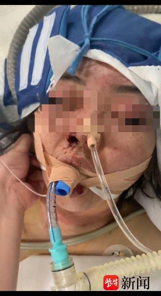 “女子新婚两月遭丈夫家暴致失明案”二审维持原判:男方犯故意杀人罪获刑11年