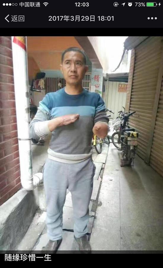 王忠馗受伤4个多月后,妻子拍下照片并配文“随缘珍惜一生”。 受访者供图