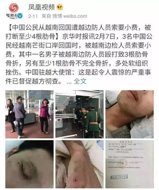 中国公民被越南边检人员索要小费不成被殴打致骨折 新闻来源:凤凰视频