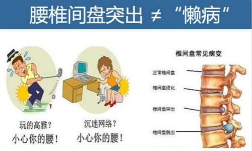 腰间盘突出怎样治疗才能更有效