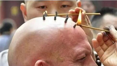 和尚的戒疤有几个?烧戒疤是佛教制度吗?