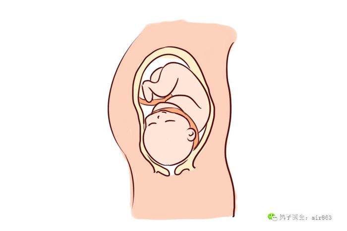 仅仅是孕期短暂缺氧，也有可能导致婴儿脑损伤
