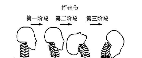 从C-NCAP看汽车座椅安全系统的重要性