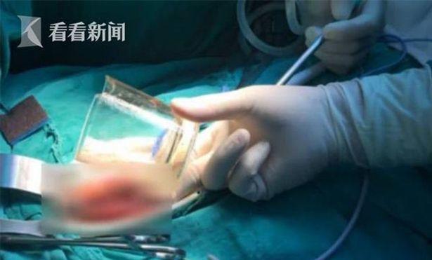 已婚男塞直径7公分广口玻璃杯进肛门