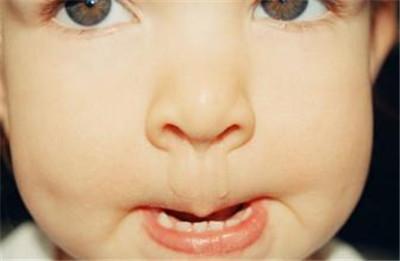 小孩鼻炎什么症状？这些表现最常见！