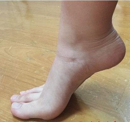 女大学生“脚趾长成了手”，被人称“稀有动物”，网友：用着真棒