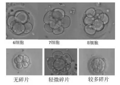 試管嬰兒多次移植不著床或生化,怎么辦?我這么做后終于成功了!