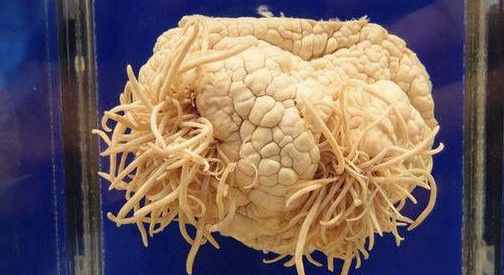 世界十大最奇葩的博物馆 奇葩博物馆毁三观