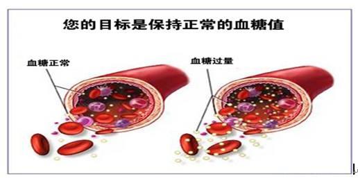 内分科主任：糖尿病很怕这6种蔬菜，糖友多吃点