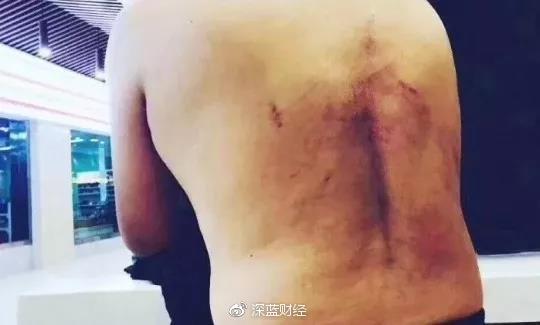 陕西广电记者被关太平间，“来一个记者杀一个”是什么猖狂逻辑？