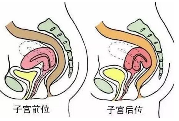 子宫前位/后位，会影响怀孕吗？