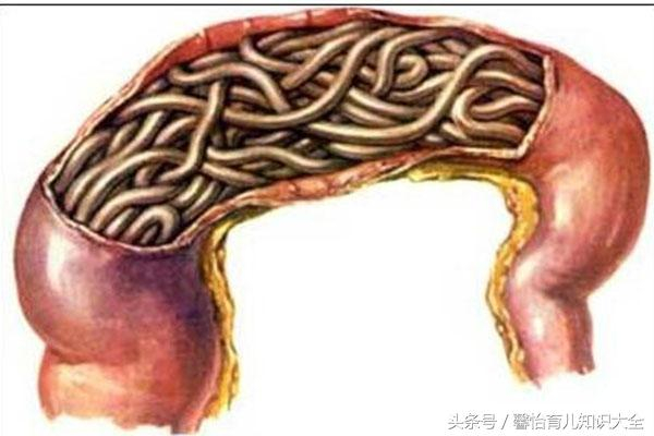 6岁女童饭前总闹肚子疼，吃完胃药也没用，医生怒斥宝妈太无知了