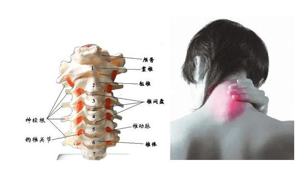肩膀疼不一定就是颈椎病，这些小症状很有可能也是信号