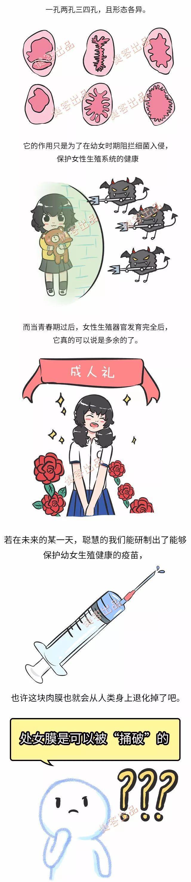 处女膜 