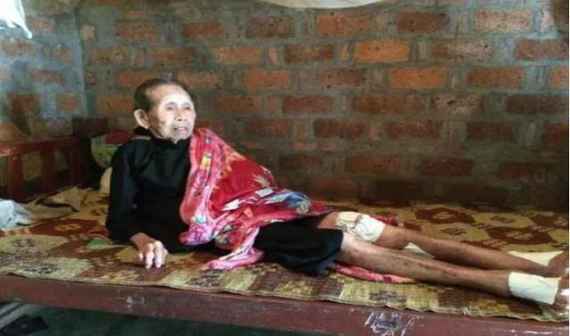 梦见自己腿断了,周公解梦揭示深层含义 梦见自己腿断了,周公解梦揭示深层含义