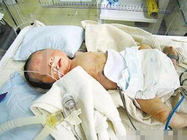 29岁产妇生下二胎出产房, 只因无人问津, 怒将新生儿摔地上!