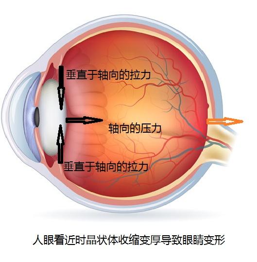 你的眼睛近视的过程中到底发生了哪些变化？（原理篇）