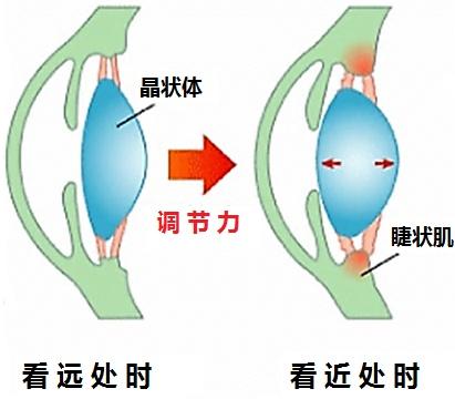 你的眼睛近视的过程中到底发生了哪些变化？（原理篇）