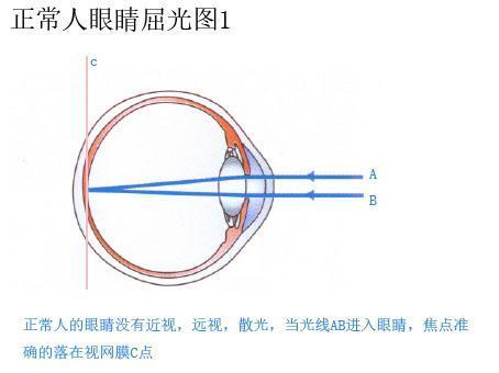 你的眼睛近视的过程中到底发生了哪些变化？（原理篇）