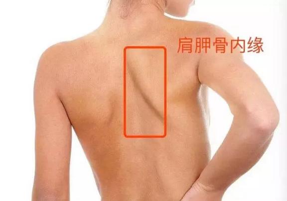 翼状肩胛是什么??