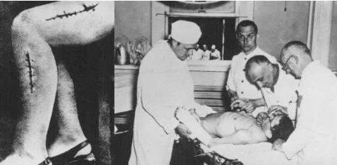 二战时德国拿犹太人做人体冷冻实验，惨目忍睹。