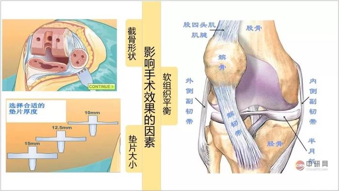 ppt图片排版：如何让对比图更直观明了