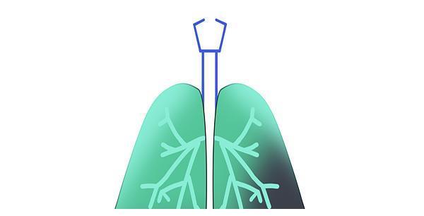 体检出肺部有阴影，是怎么回事？可能是这4种原因引起的