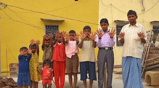 印度一家25人600只指头，个个都是六指，遗传的威力真大！
