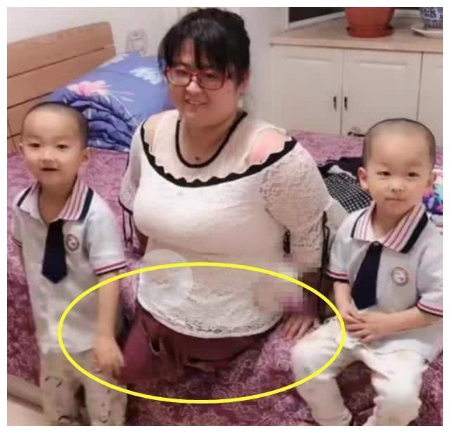 “无腿”妈妈试管生下双胞胎，5年过后，孩子们成为了母亲的双腿