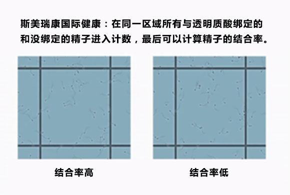 PISCI技术：选一个好精子对试管婴儿真的很重要