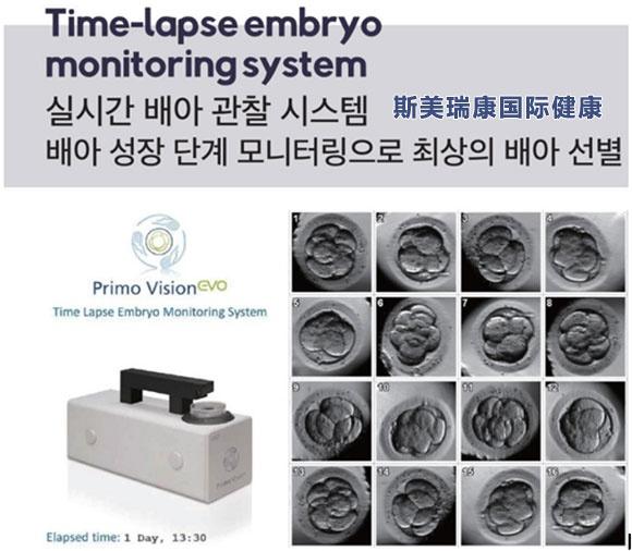 Time-lapse胚胎实时监测系统24小时实时监测并选择最优质胚胎
