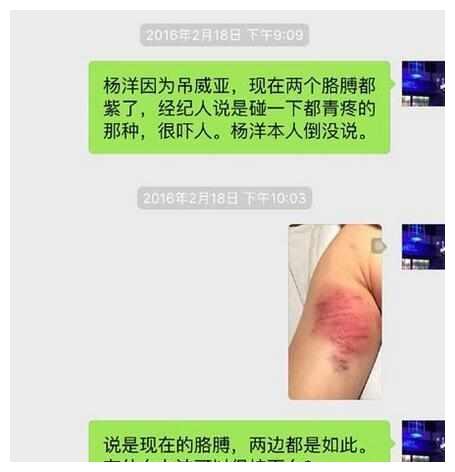 明星吊威亚有多危险？于朦胧高空摔下，黄晓明骨折，刘诗诗险丧命