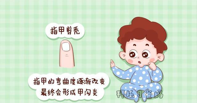 宝宝患上甲沟炎，竟是因为剪指甲造成，后果很严重