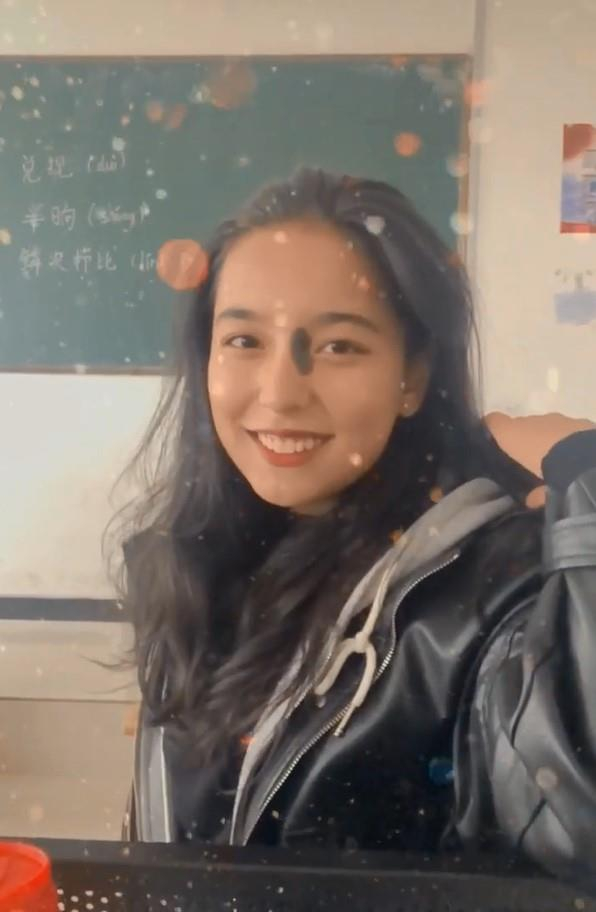 “钻石胎记女孩”走红抖音，当她回眸，网友：绝世美人！