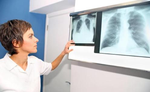 急性肺栓塞是什么疾病？了解3个病因，提早预防
