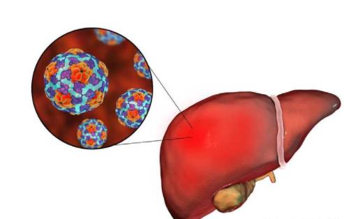 慢性肝炎患者，日常需要注意什么？记得这3件事能养肝