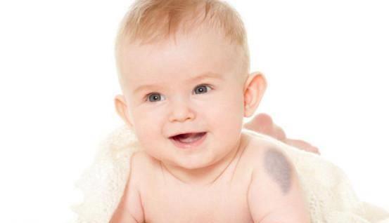 刚出生的新生儿身上为何有带青黑色的胎记，并不会影响宝宝健康