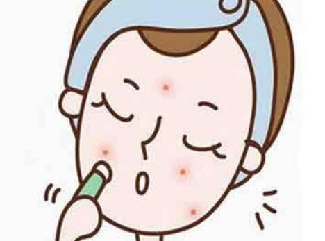 祛痘药膏有哪些副作用？在用之前，请提前知晓
