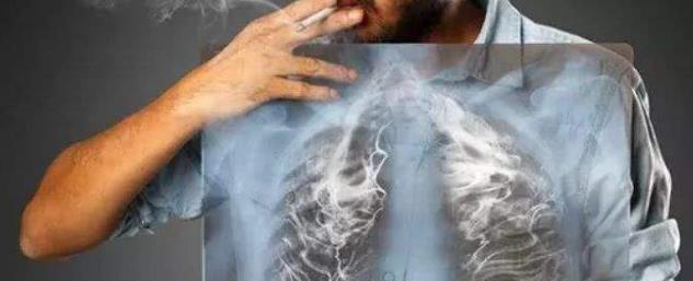 它是天然的肺部“除尘机”，清肺止咳排毒素，现在了解为时不晚