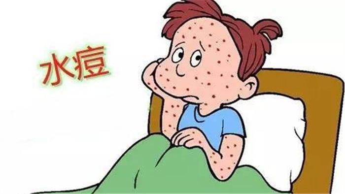 孩子平时应该怎样预防水痘的发生？