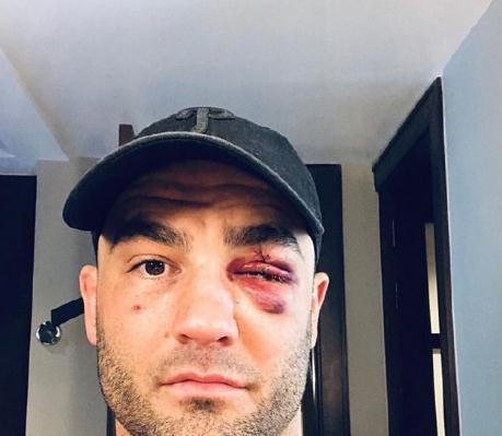 UFC 前王者阿尔瓦瑞兹倒下了，他还能站起来吗？