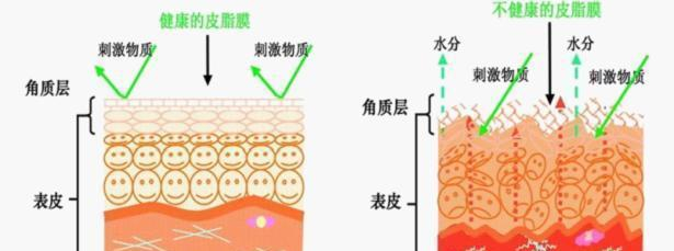 毛孔粗大还反复冒痘，是不是皮脂膜没保护好？