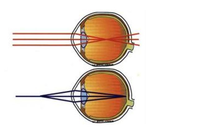 如果一个近视超过500度的人，长期不戴眼镜，视力会有什么变化？